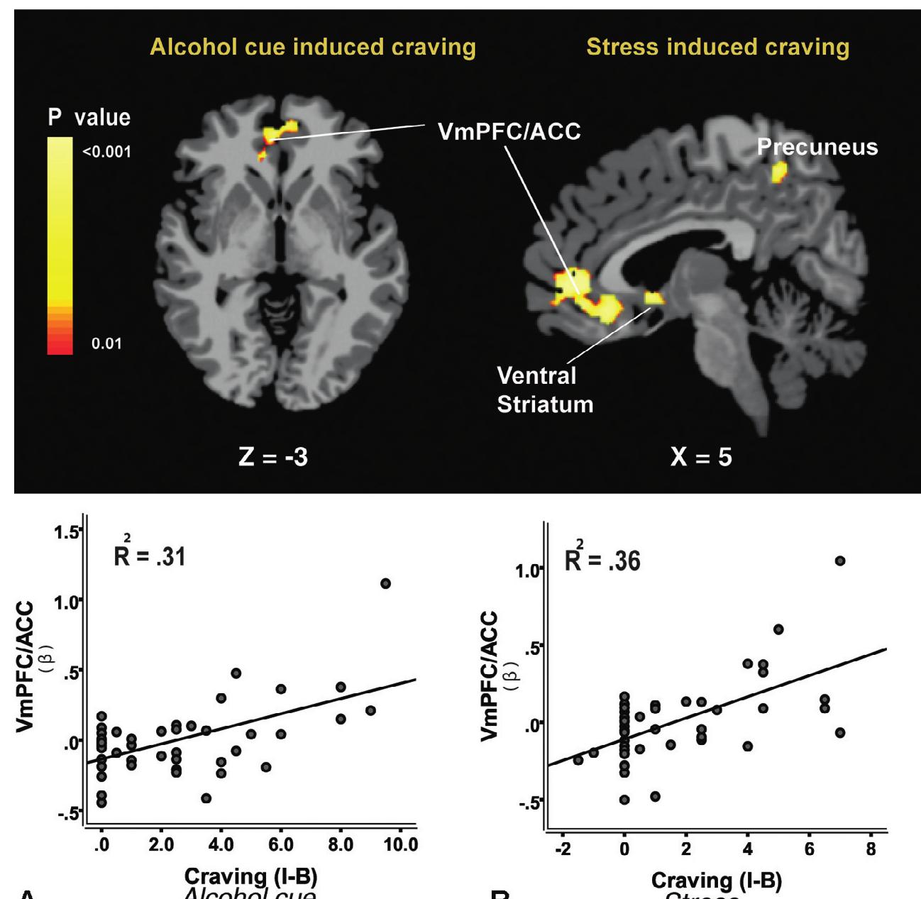 (PDF) The neurobiology of alcohol craving and relapse