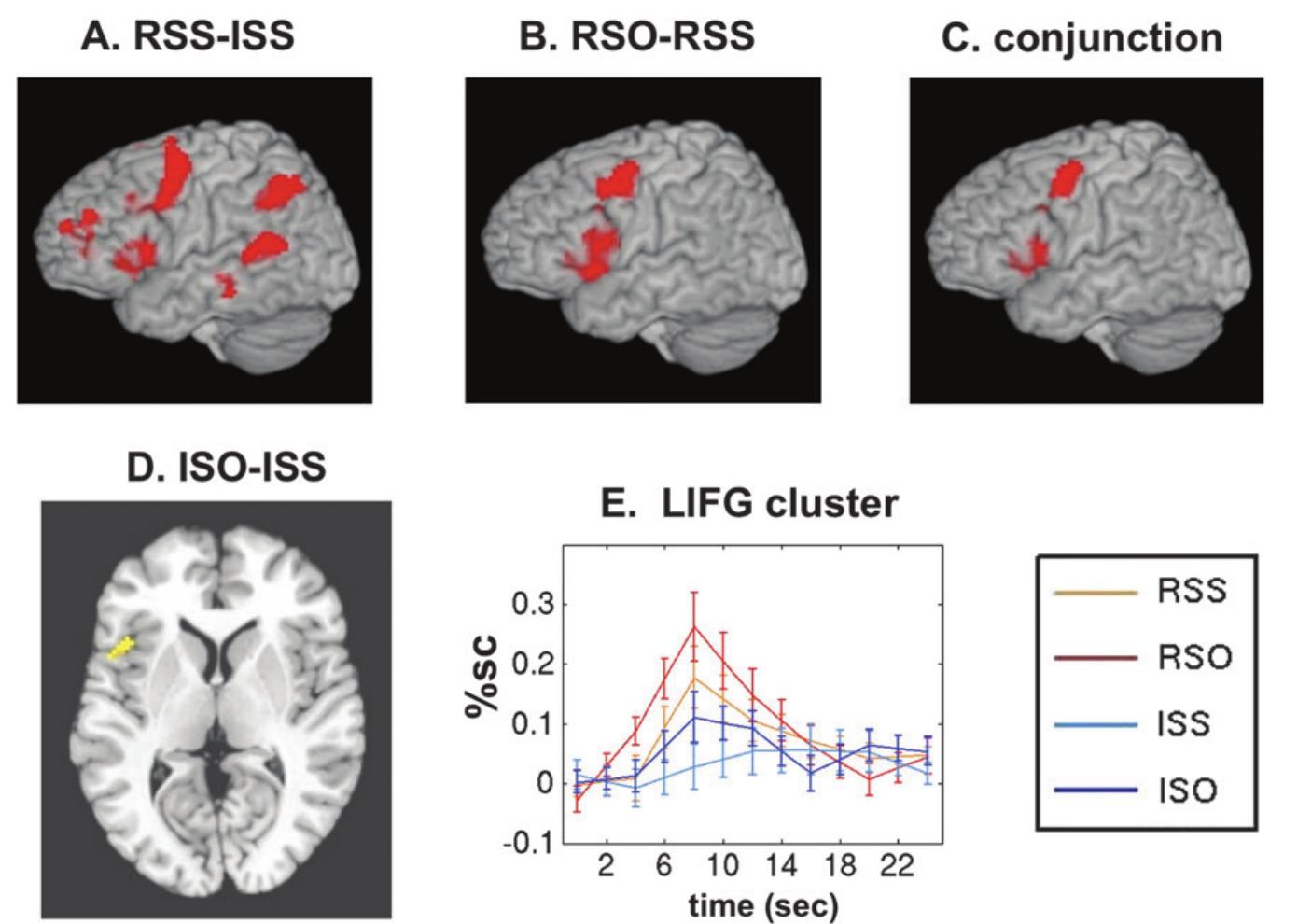Figure 4. Individual condition contrasts. (A) Reversible subject embedded versus irreversible subject embedded. (8) Reversible object embedded versus irreversible objec embedded. (C) Conjunction of the above 2 contrasts, showing overlap in frontal regions. (D) Irreversible object embedded versus irreversible subject embedded, detected witt small-volume correction. (£) Average time courses of the response to sentence presentation in a 3-mm radius spherical RO! centered on the LIFG cluster showing the ISO-IS§  effect (Talairach —44, +13, +7). 