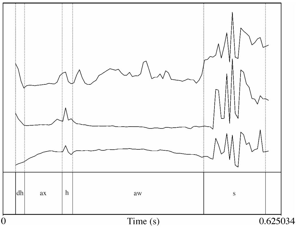 Figure 1: Formant tracks of monophthongal pronunciation of /aw/ in ‘the house’ 