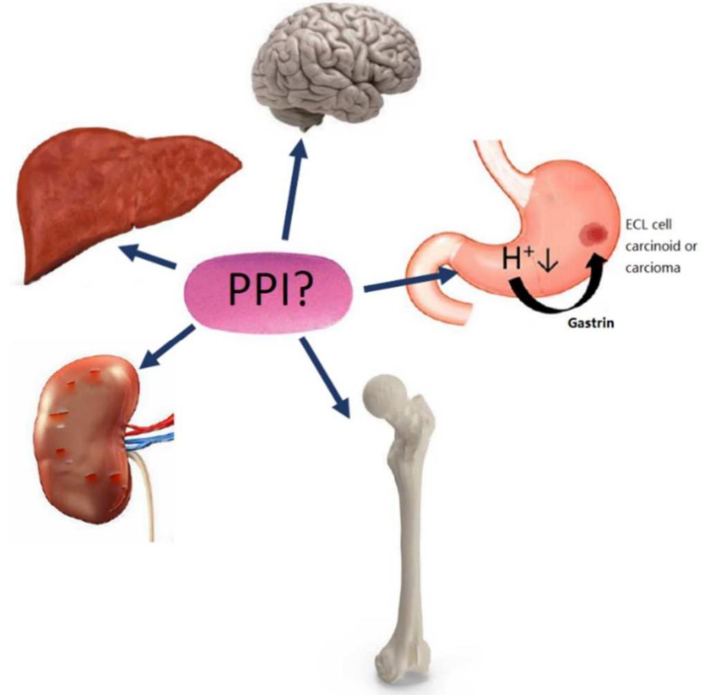 (PDF) Adverse Effects of Proton Pump Inhibitors—Evidence and Plausibility