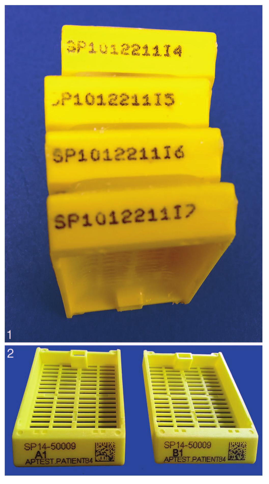 (PDF) Uniform Labeling of Blocks and Slides in Surgical Pathology ...