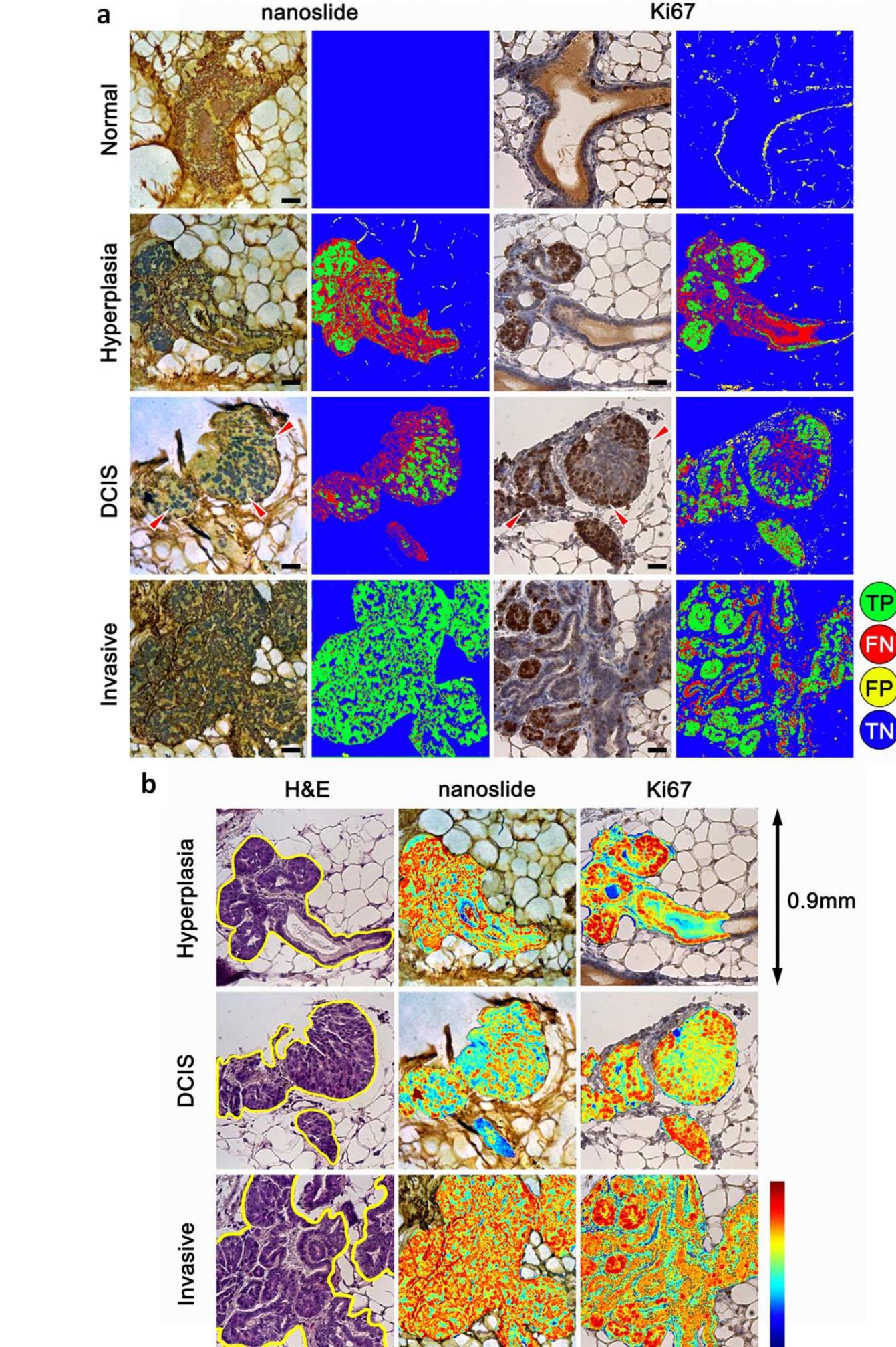 | nanoslide histology images and pathology assessment of