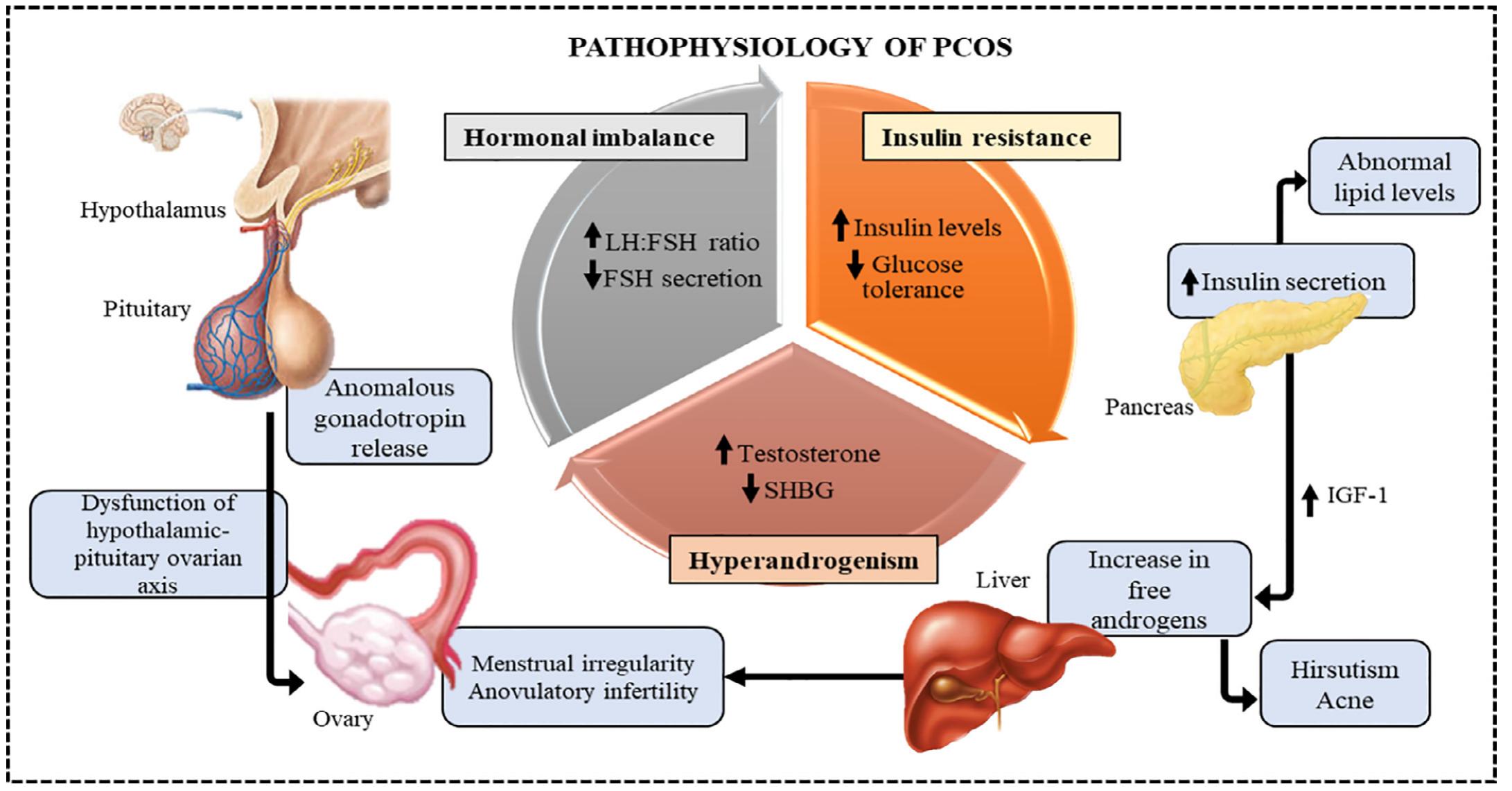 Schematic depiction of pcos linked mechanism. (walters et