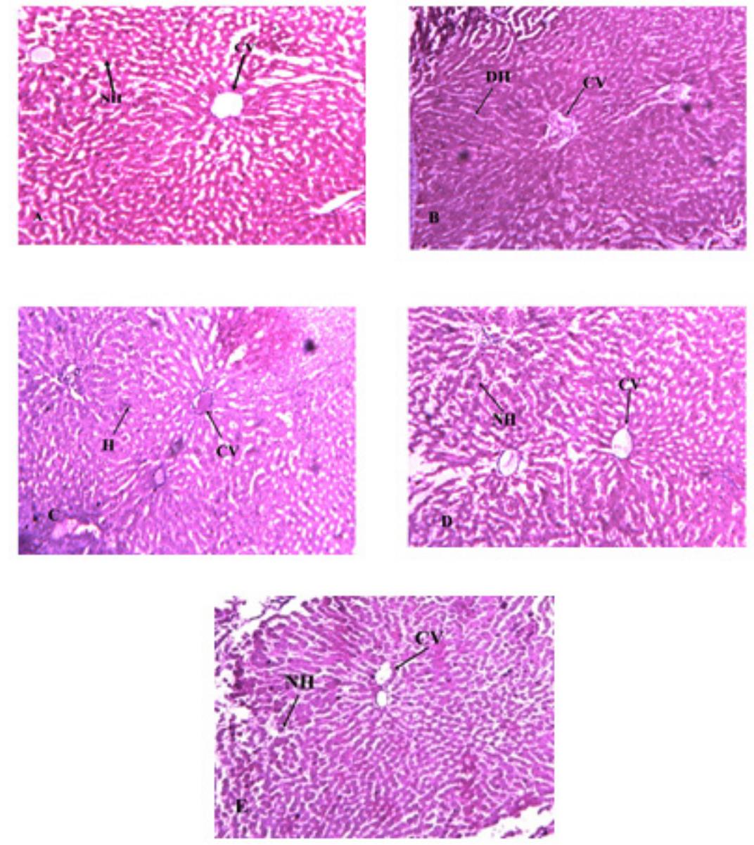 Section a showing normal histology of liver of nd