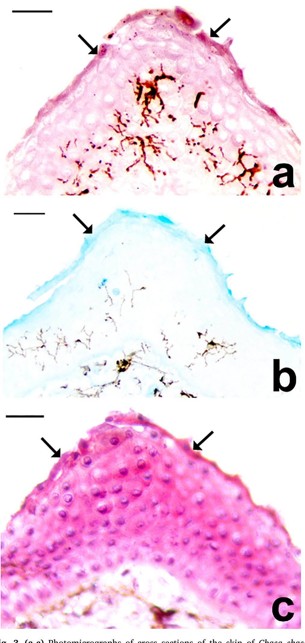 Figure 3 - Keratinization and mucogenesis in the epidermis