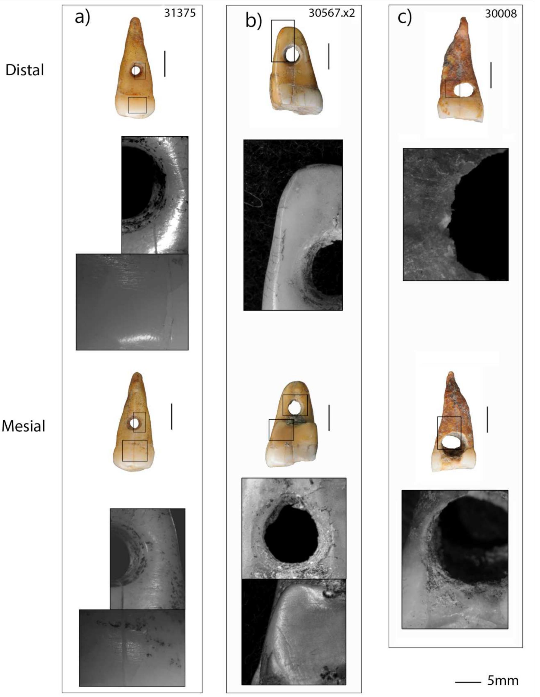 Human Teeth Modifications Figure 3 - from An analysis of modified human teeth at