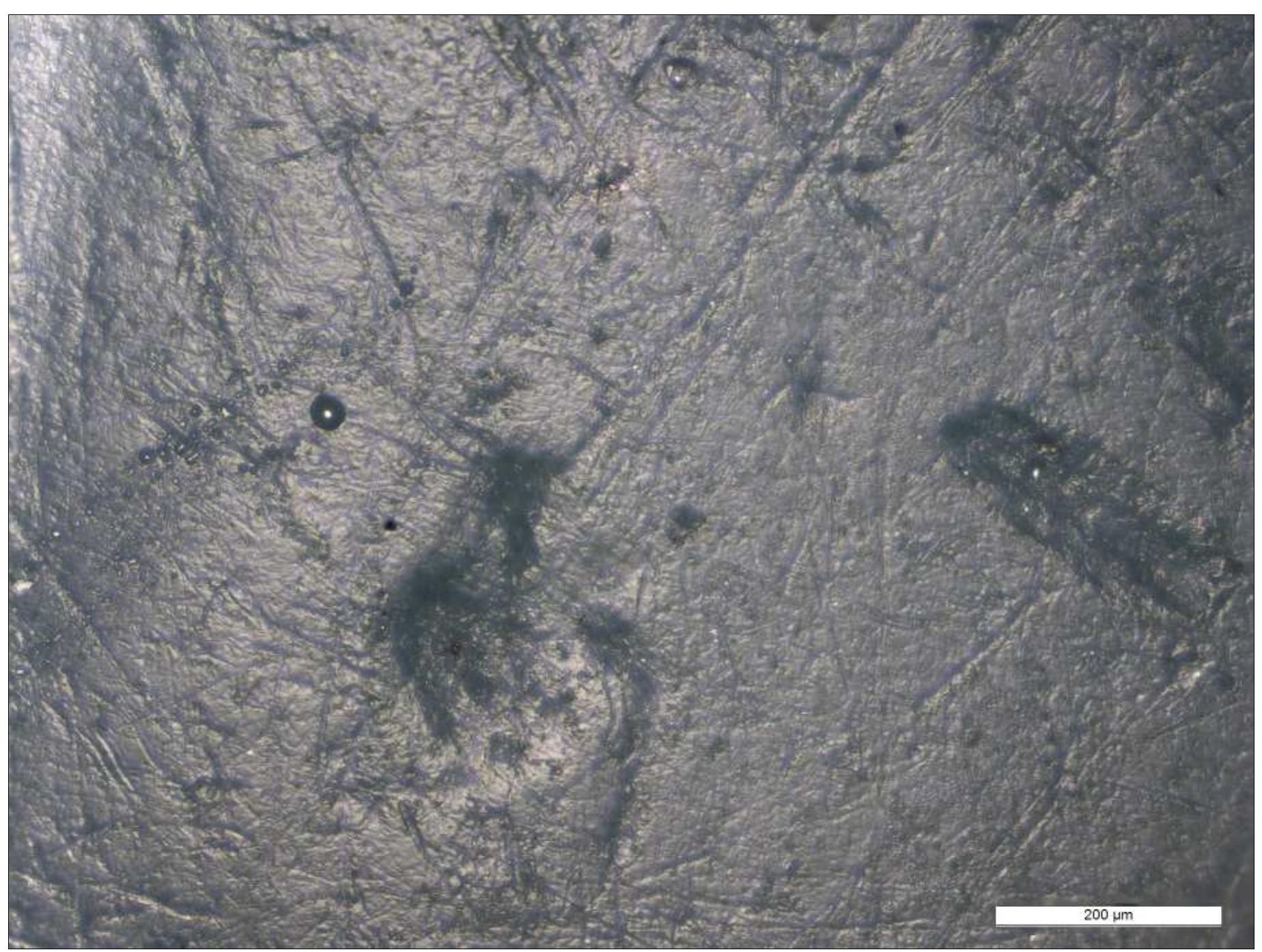 Human Teeth Modifications Figure 3 - from An analysis of modified human teeth at