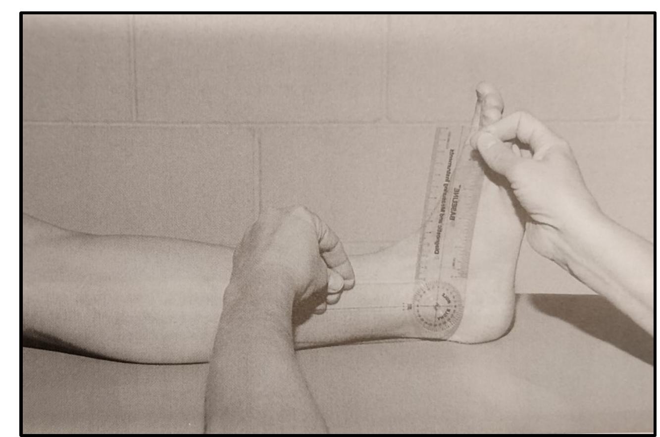 3: goniometer alignment for measurement of ankle