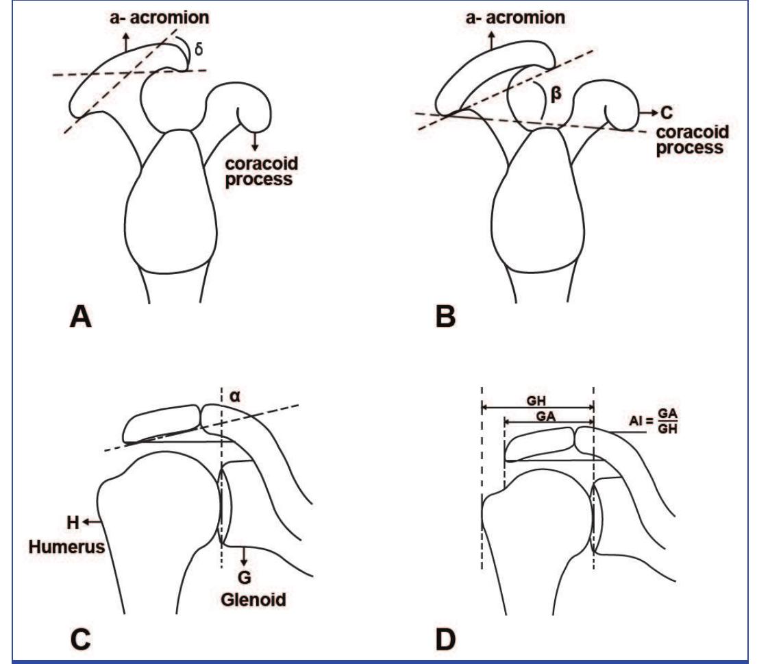 (PDF) Shoulder Impingement and its Association with Acromial Morphology ...