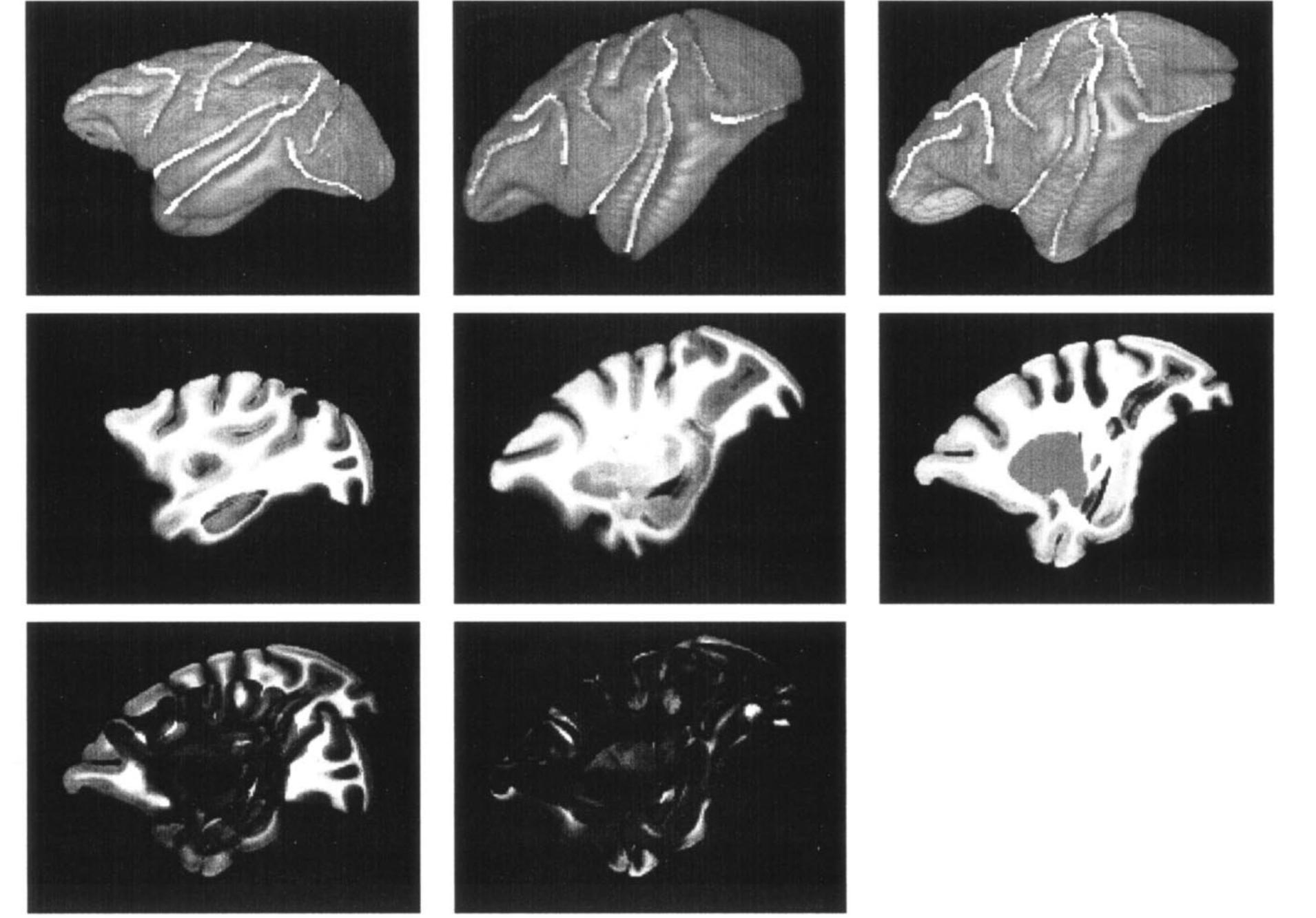 Top row shows the volume rendering of the template 87a (left
