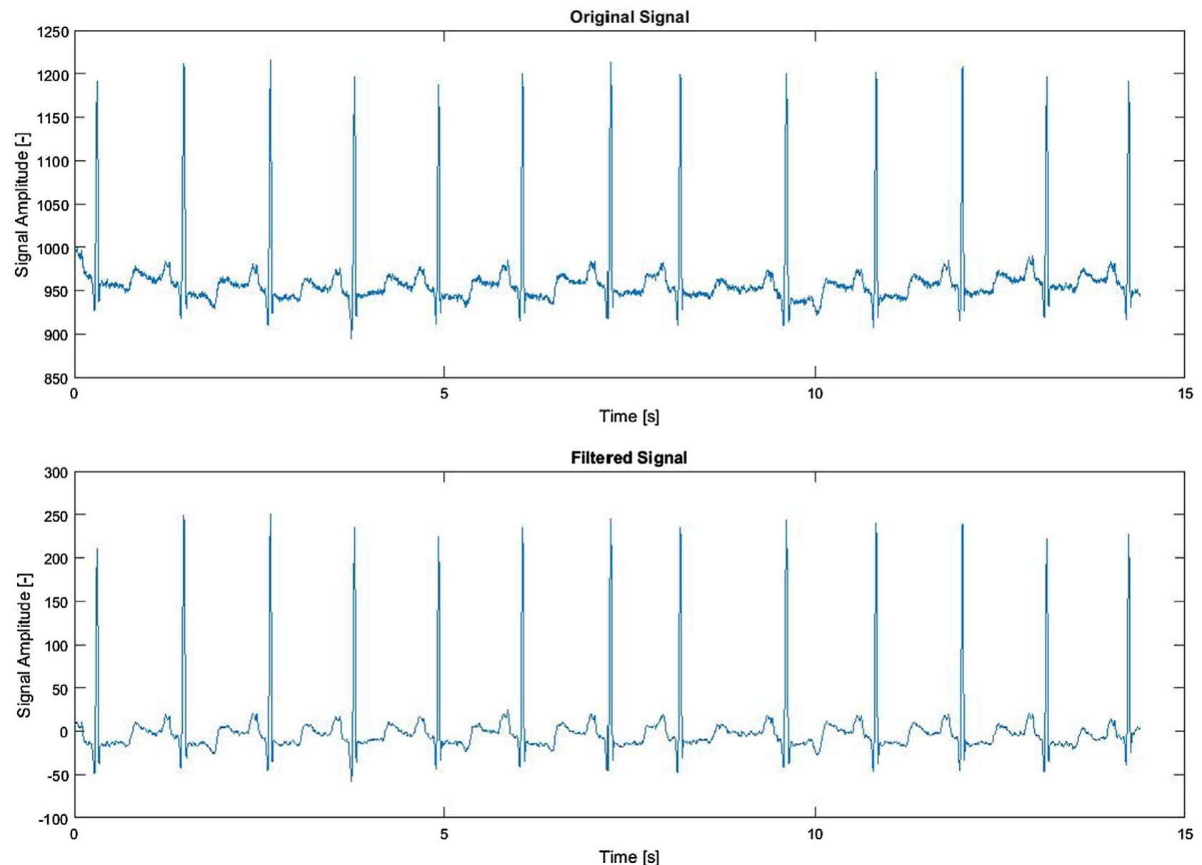 Figure 2 - from Smart Heart Monitoring: Early Prediction of