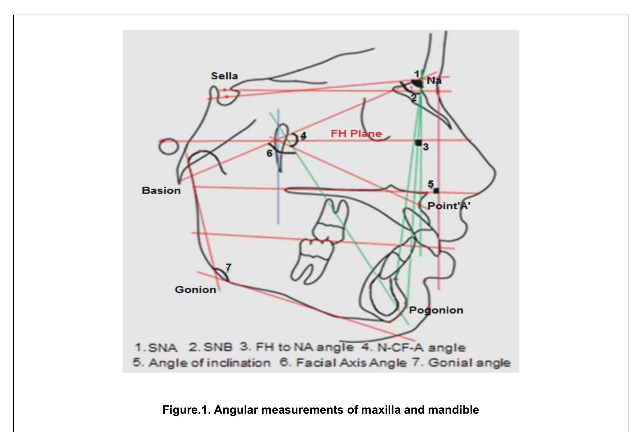 (PDF) Cephalometric Analysis for Orthognathic Surgery