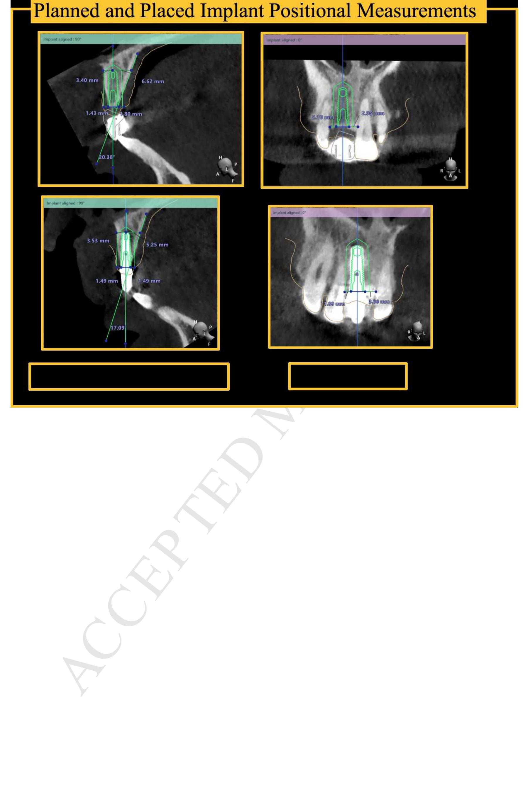 Implant Guide Direction (PDF) How Accurate Are Implant Surgical Guides Produced With Desktop ...