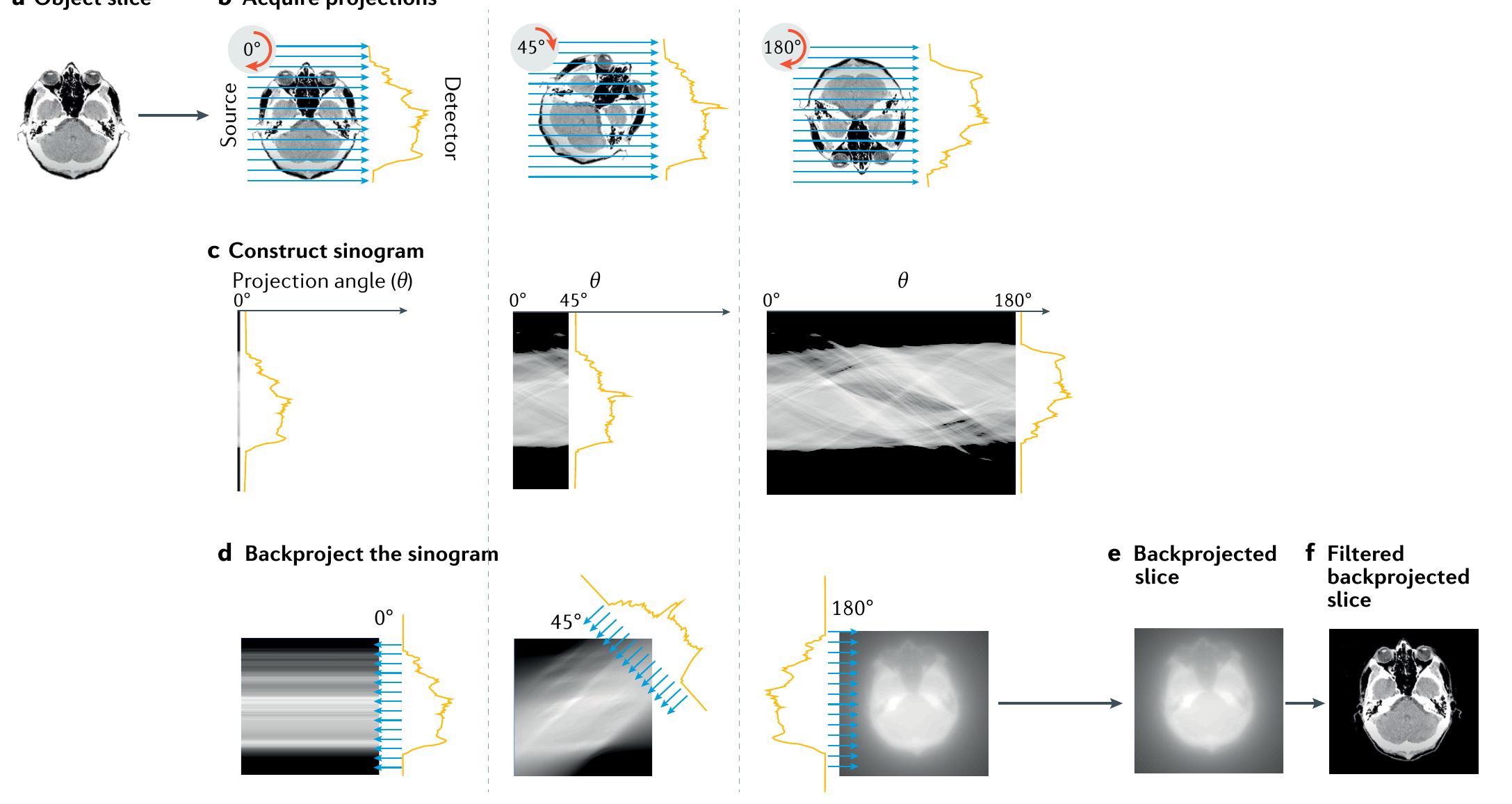 (PDF) X-ray computed tomography