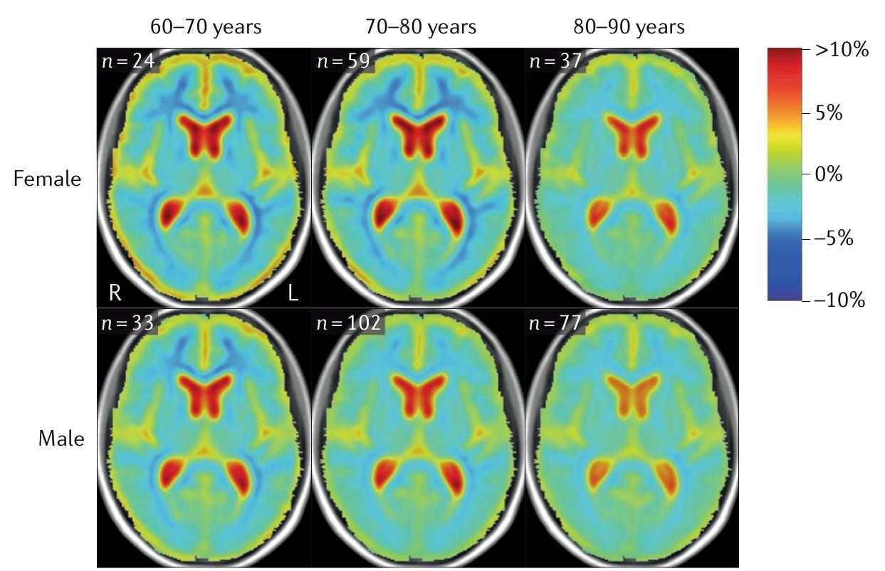 (PDF) Sex differences in Alzheimer disease — the gateway to precision ...