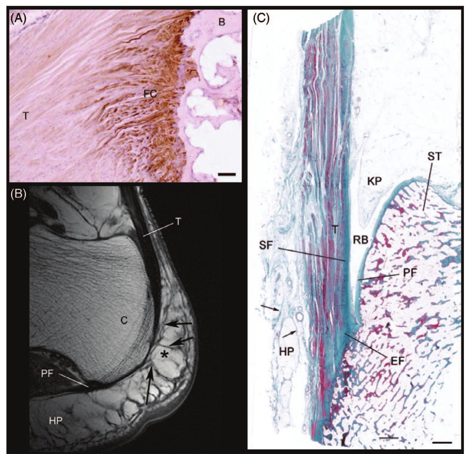(PDF) The equine navicular apparatus as a premier enthesis organ ...