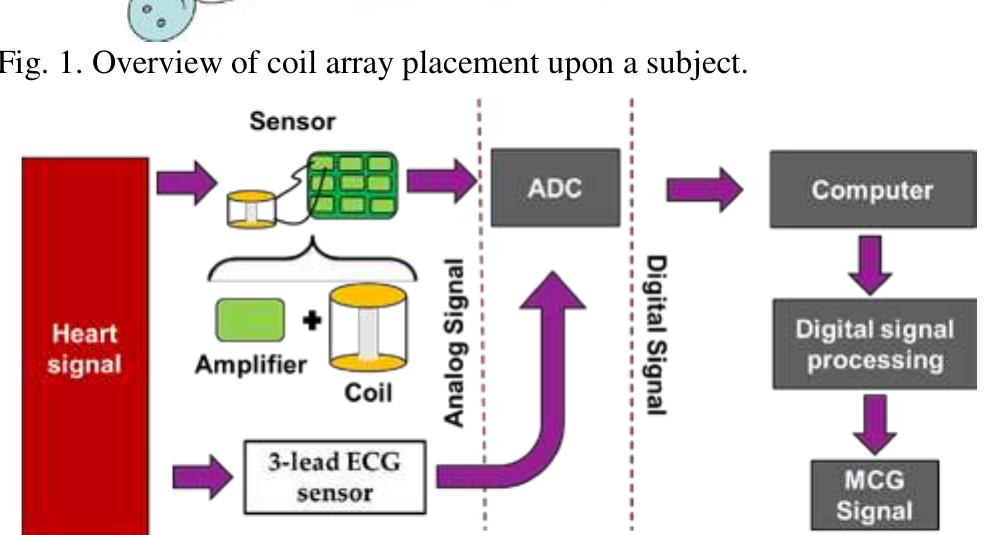 Mcg Sensor Array Block diagram showing an overview of our experimental