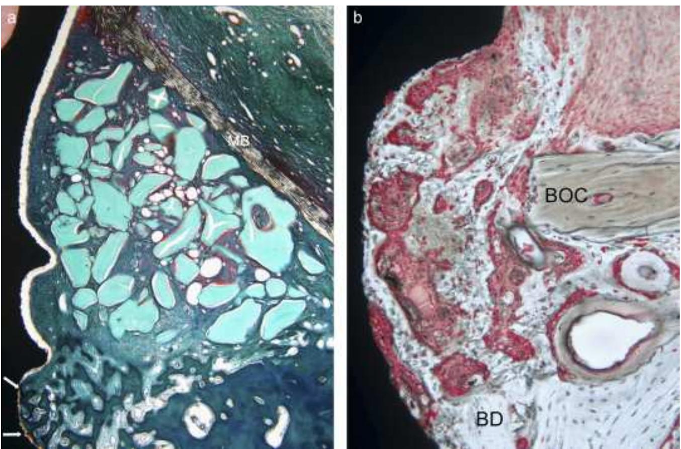 Wound Staining Representative histological views of wound healing at 2