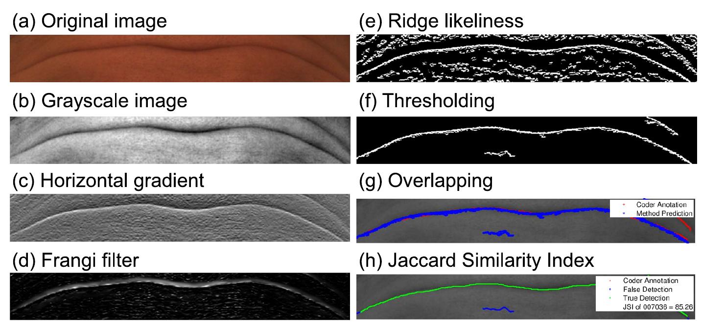 (PDF) Automatic Wrinkle Detection Using Hybrid Hessian Filter