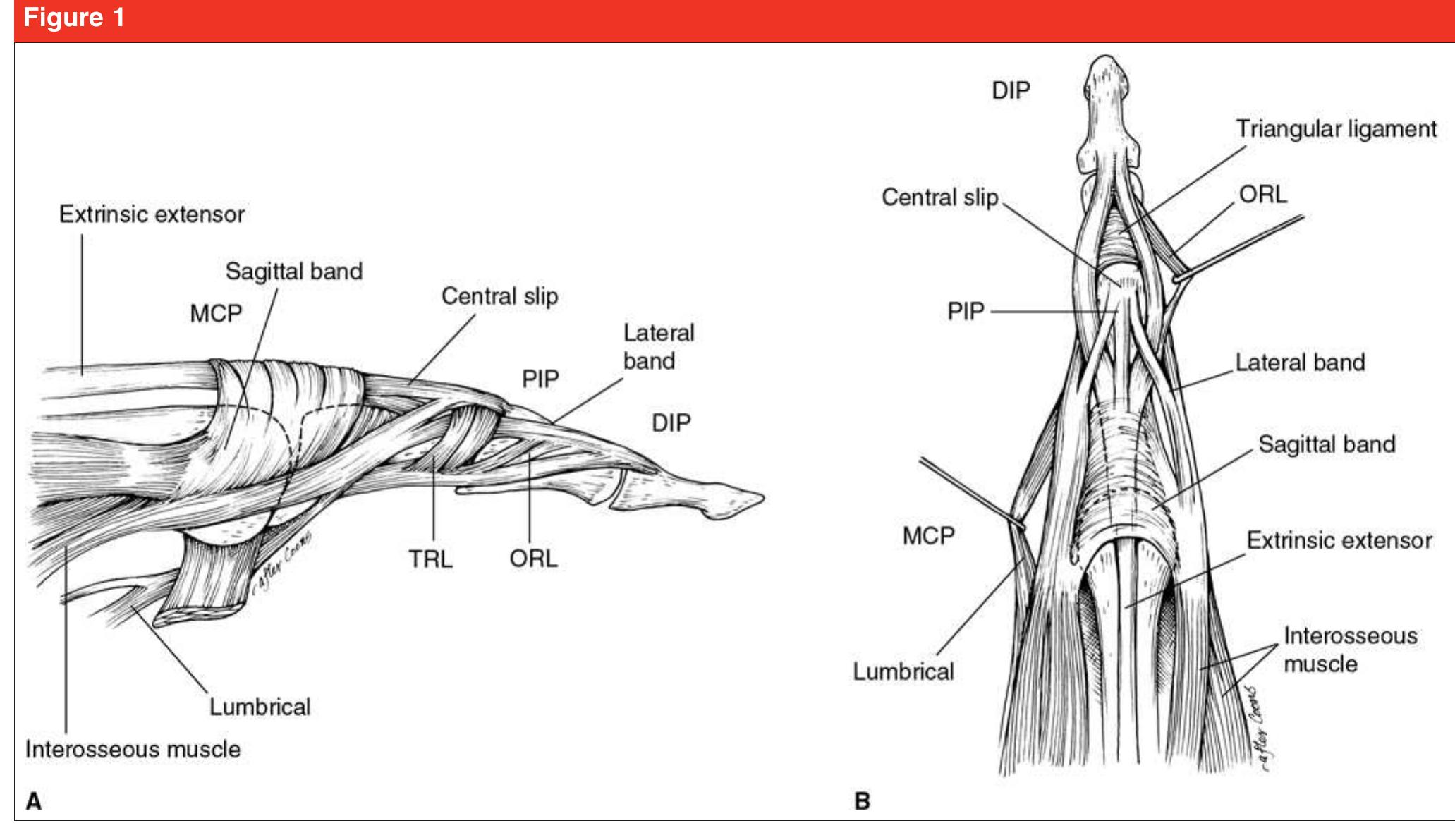Illustration of finger extensor mechanism anatomy. a,