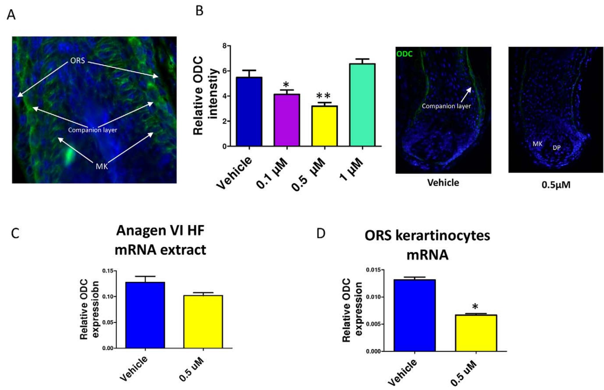 Figure 2. Spermidine treatment down-regulates ODC expression in the HF. A. Immunoreactivity of ODC in the proximal HF demonstrates moderate ODC expression in the matrix keratinocytes, and strong expression in the proximal companion layer. B. Spermidine treatment for 6d decreased ODC immunoreactivity in the lower doses (0.1 and 0.5 uM). Columns represent means+SEM; n= 9-13 HFs/group C. By Q-PCR, spermidine treatment for 24 h slightly decreased the ODC transcript steady-state levels in human anagen HF mRNA extracts, compared to PPIA, although this did not reach significances. D. However, spermidine significantly down regulated ODC transcription in cultured human ORS keratinocytes after 48 h. *P<0.05. Columns represent means+SEM. Results represent triplicate determinations of samples. Total RNA was pooled from 20 HFs. DP, dermal papilla; MK, matrix keratinocytes; ORS, outer root sheath.  doi:10.1371/journal.pone.0022564.q002 