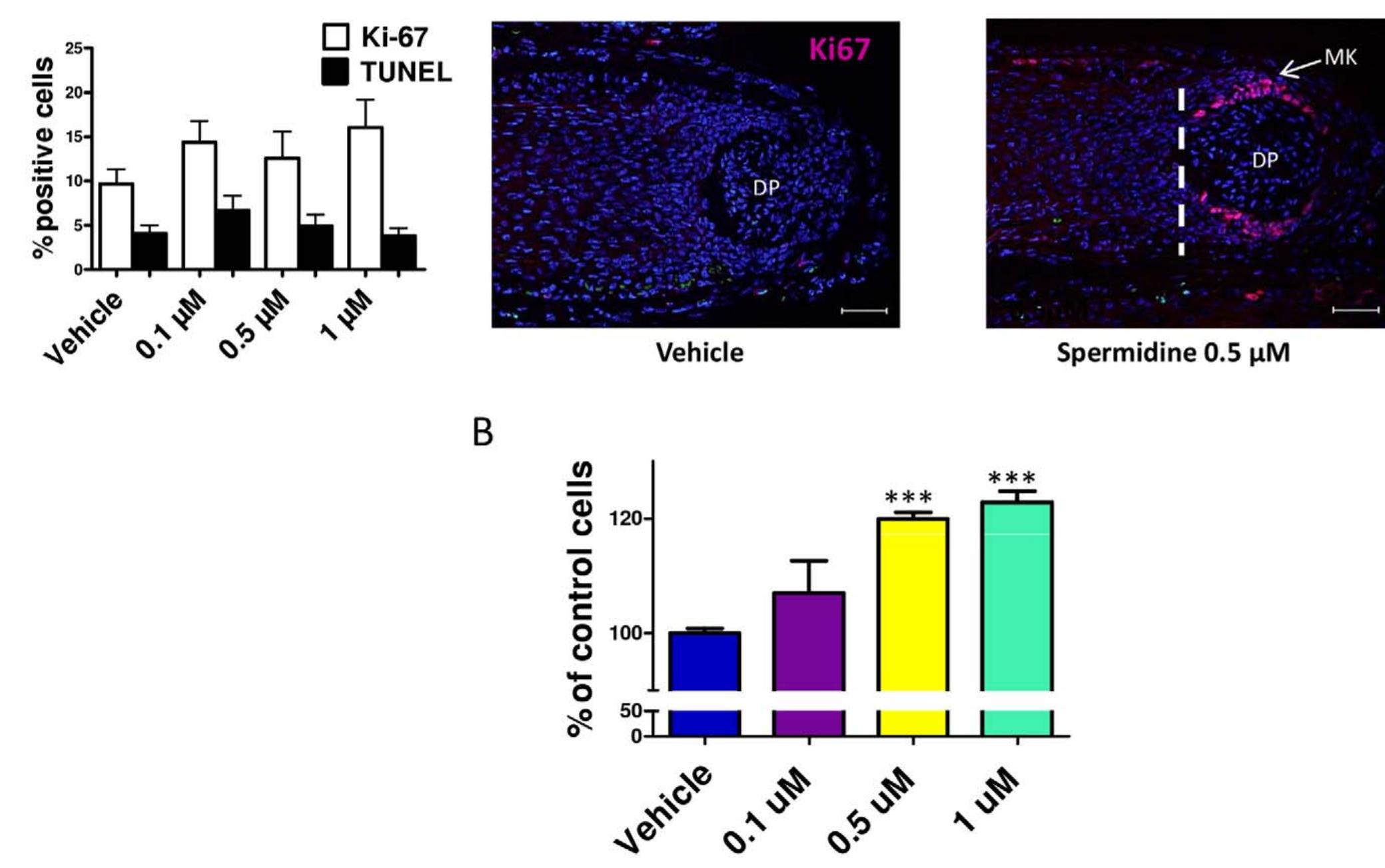 Figure 3. Spermidine stimulated proliferation of primary human keratinocytes and tended to stimulate hair matrix keratinocytes. A. By quantitative Ki67/TUNEL immunohistomorphometry, spermidine tended to slightly stimulate hair matrix keratinocyte proliferation in situ; however, this did not reach statistical significance. No effect was seen on hair matrix keratinocyte apoptosis in situ. Columns represent means+SEM; n=30-36 HFs/group; cumulative results of two different experiments. B. Spermidine significantly stimulated proliferation of primary human keratinocytes after 48 h, as assessed by fluorimetric proliferation assay. The values shown are means+SEM of triplicate experiments. Scale bars, 50 um. Columns represent means+SEM; ***P<0.001. DP, dermal papilla; MK, matrix keratinocytes.  doi:10.1371/journal.pone.0022564.g003 