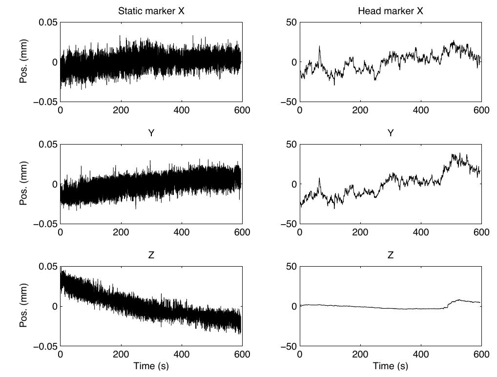 Figure 2. Example of a recording of XYZ positions (cen- tred around the mean value) of one static marker (left) and one head marker (right), from Data set #2. Duration = 10 min, SR = 20 Hz. The scaling of the Y-axes are different for the left and right plots (by a factor of 1000). 