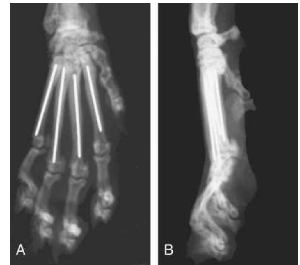 Figure 2 - from Intramedullary Pinning of Metacarpal and
