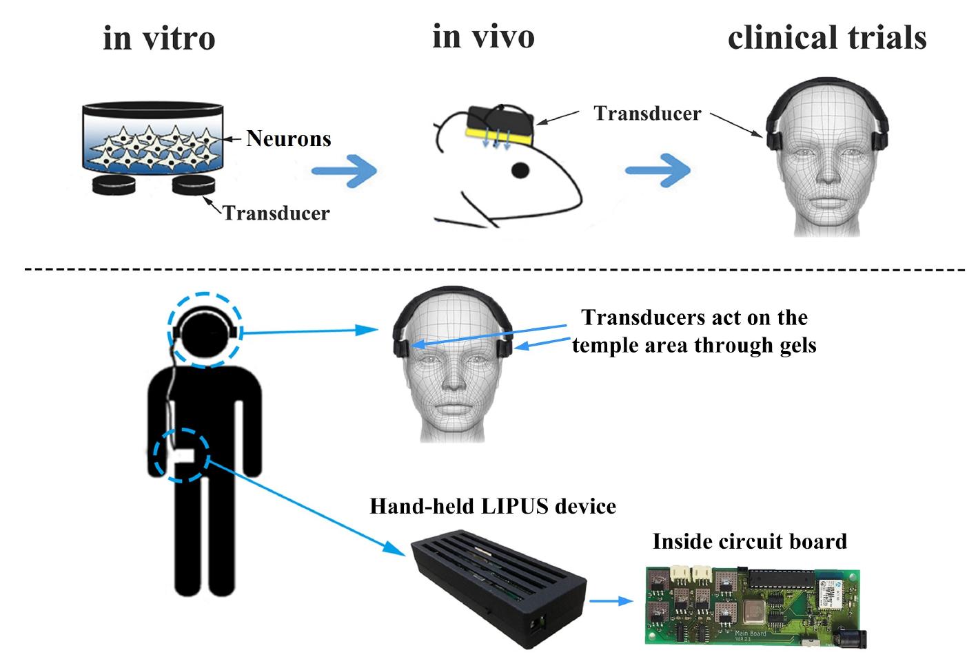 (PDF) A Review of Low-Intensity Pulsed Ultrasound for Therapeutic ...