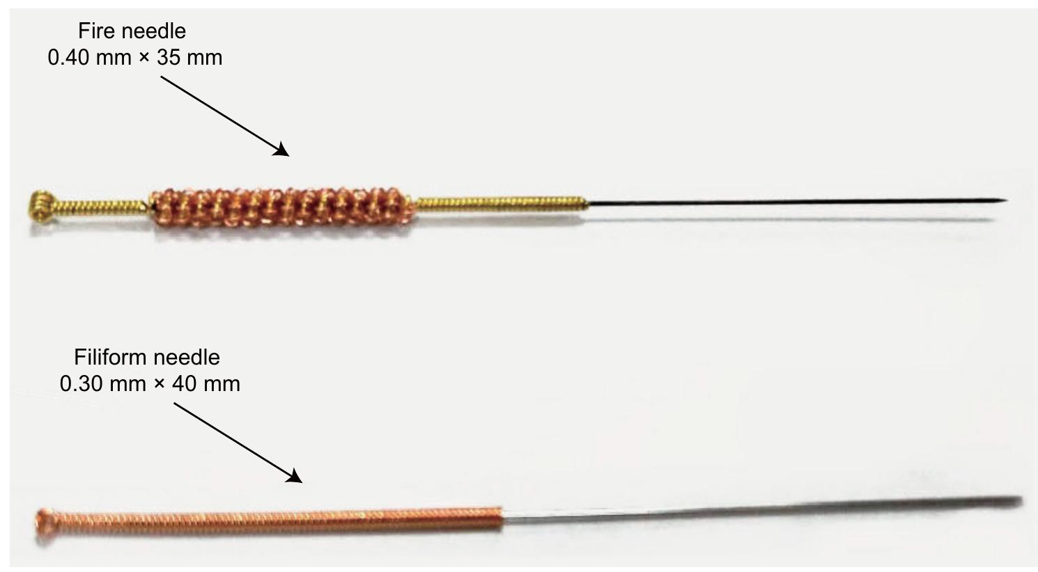 Filiform Needling Flow chart of this trial. s-fm: simplified fugl-meyer motor