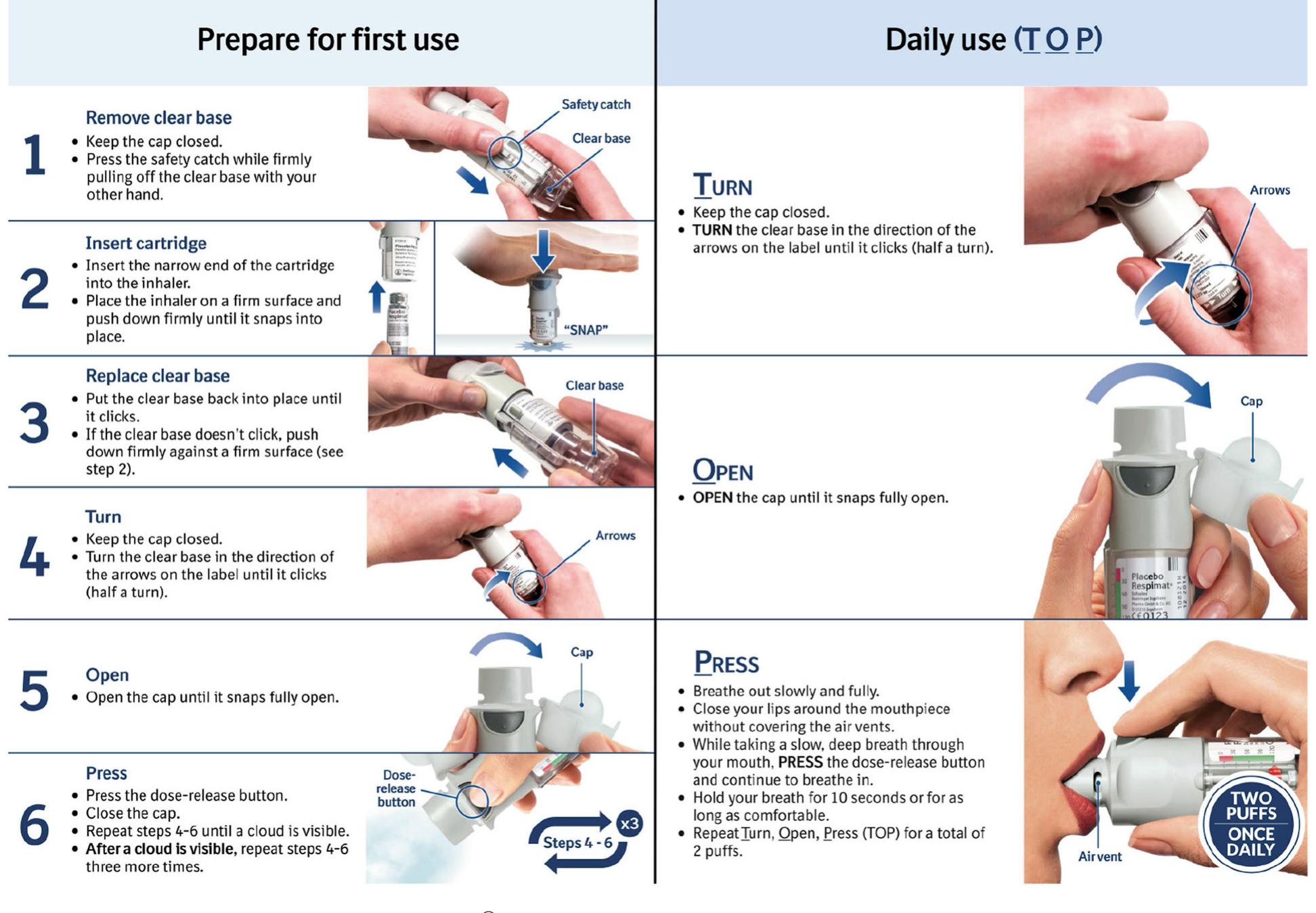 Respimat Structure (PDF) The Respimat® Development Story: Patient-Centered Innovation