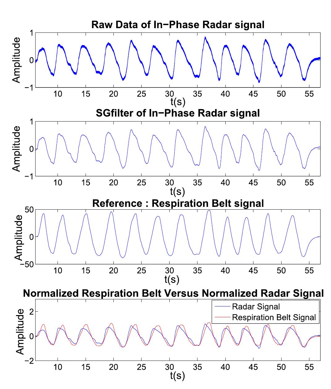 Normal breathing signal: (from top to bottom: raw radar