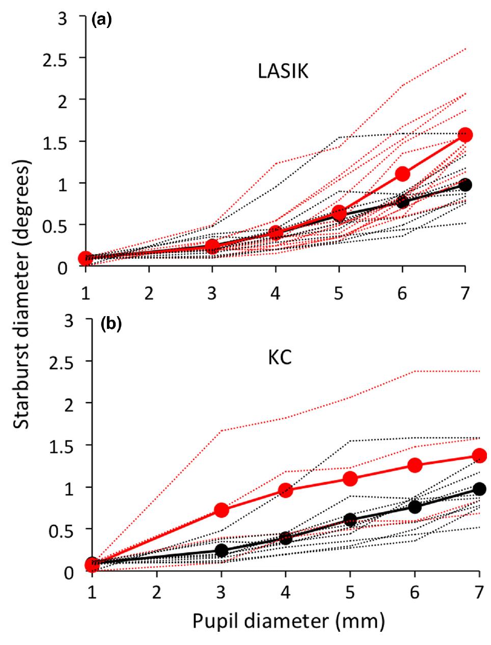 (PDF) Reducing starbursts in highly aberrated eyes with pupil miosis