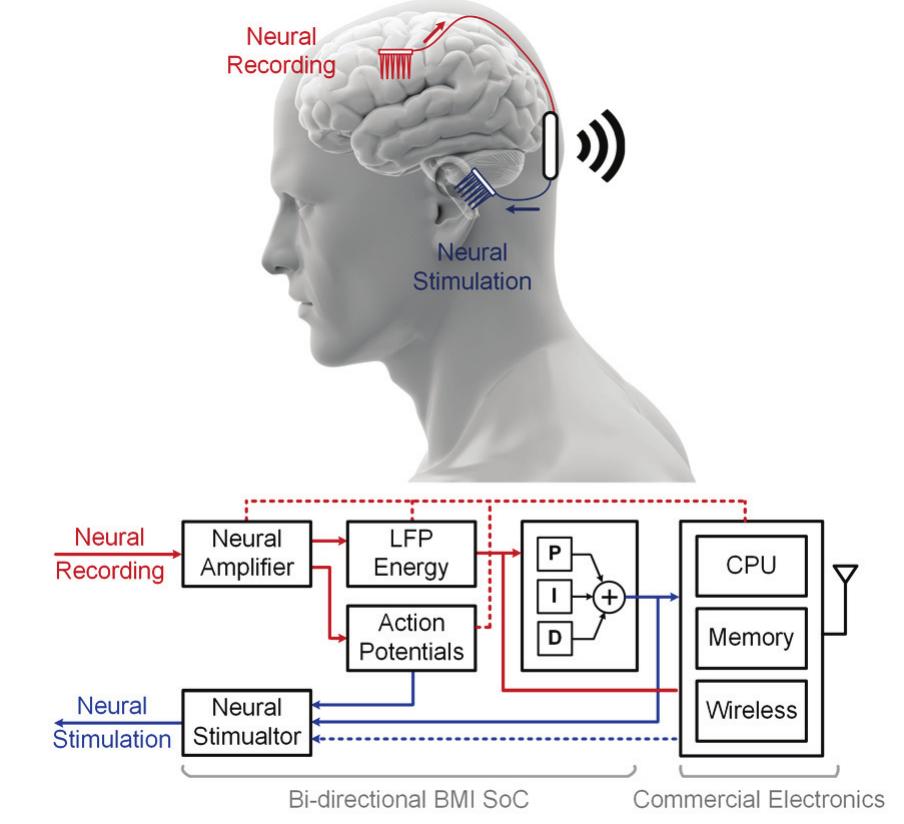 Figure 16 - Design of a Closed-Loop, Bidirectional Brain
