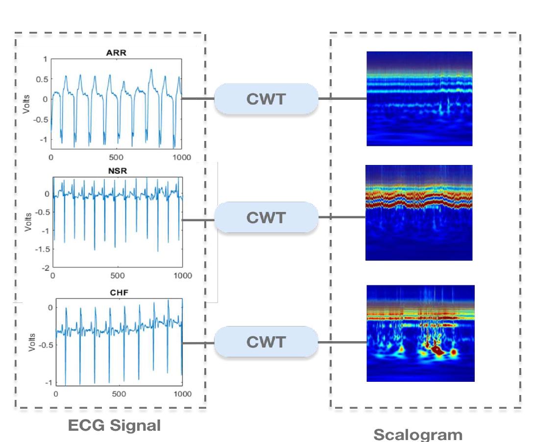Fig. 4: Conversion from ECG Signal to Scalogram Using Continuous Wavelet Transform  Fig. 3: Custom Convolutional Neural Network Architecture 