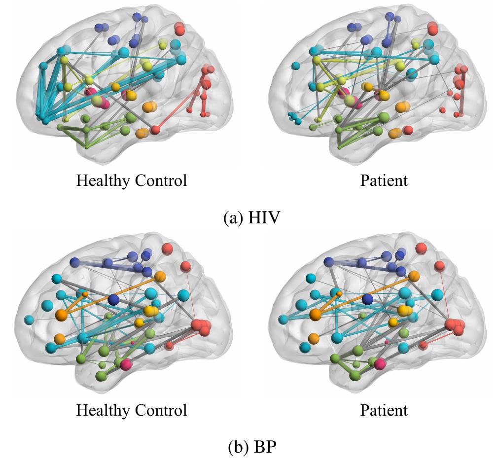 (PDF) BrainNNExplainer: An Interpretable Graph Neural Network Framework ...