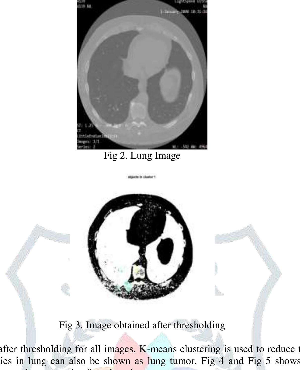 (PDF) Lung Cancer Detection using Image Processing