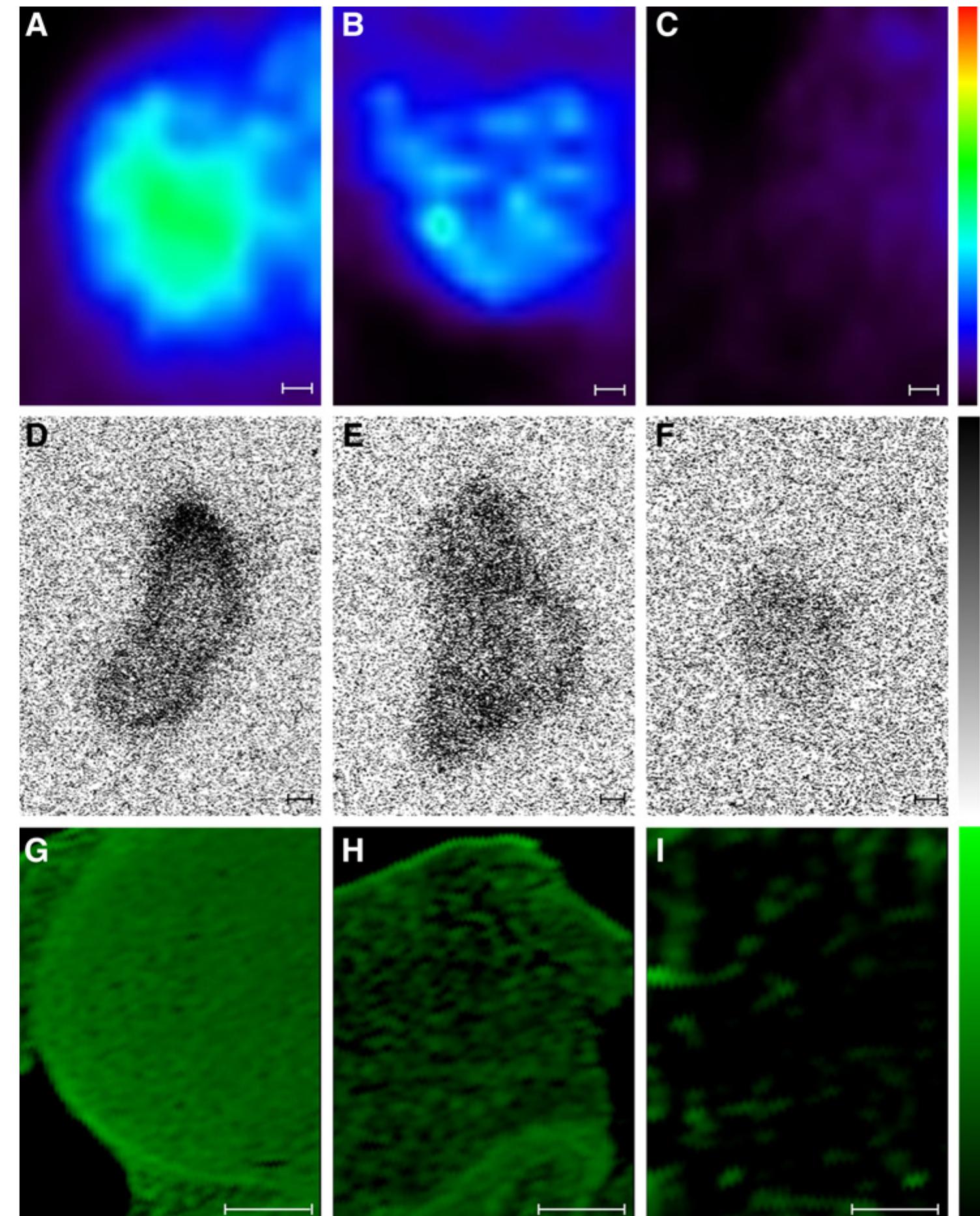 (PDF) Bicyclic Peptides as a New Modality for Imaging and Targeting of ...