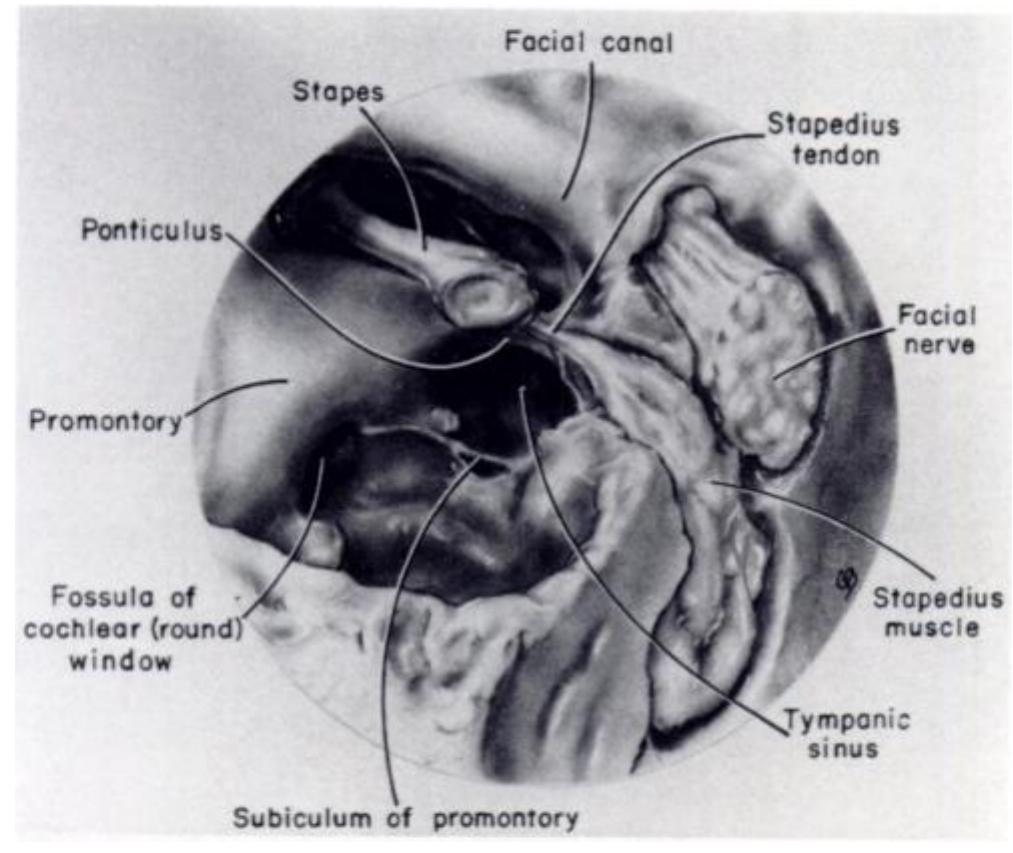 Left Promontory —a-g. a, coronal section of right temporal bone shows levels