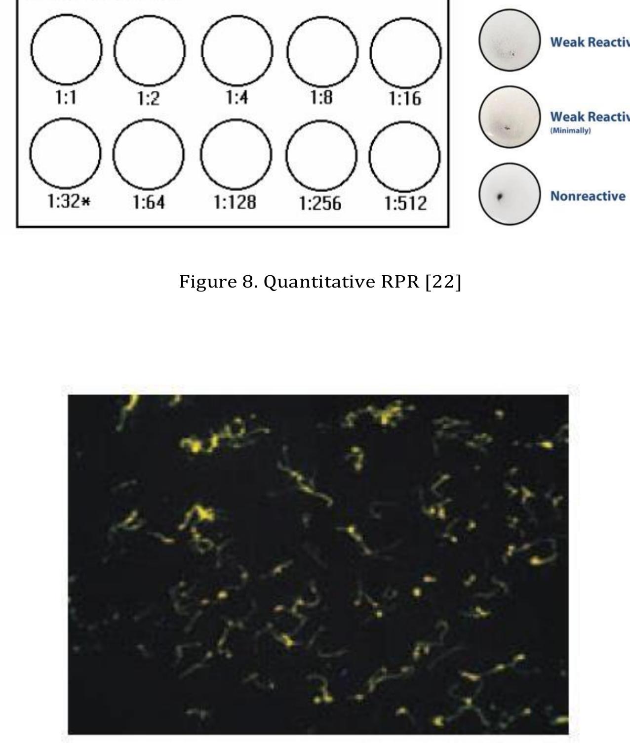 (PDF) Laboratory Examination of Syphilis