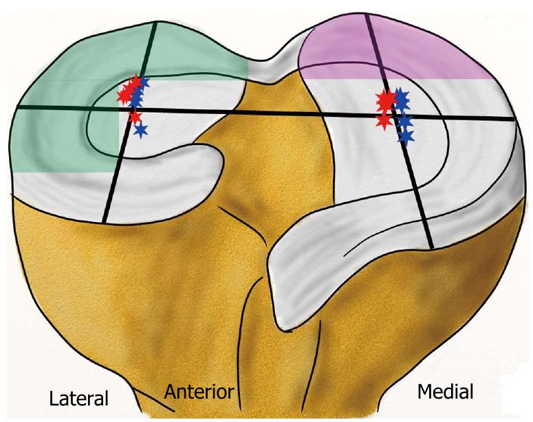 (PDF) Biomechanics of the anterior cruciate ligament: Physiology ...