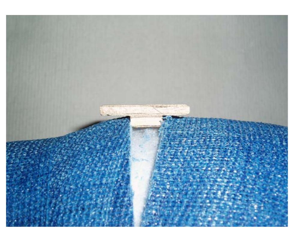 (PDF) A safer and more reliable technique for cast wedging