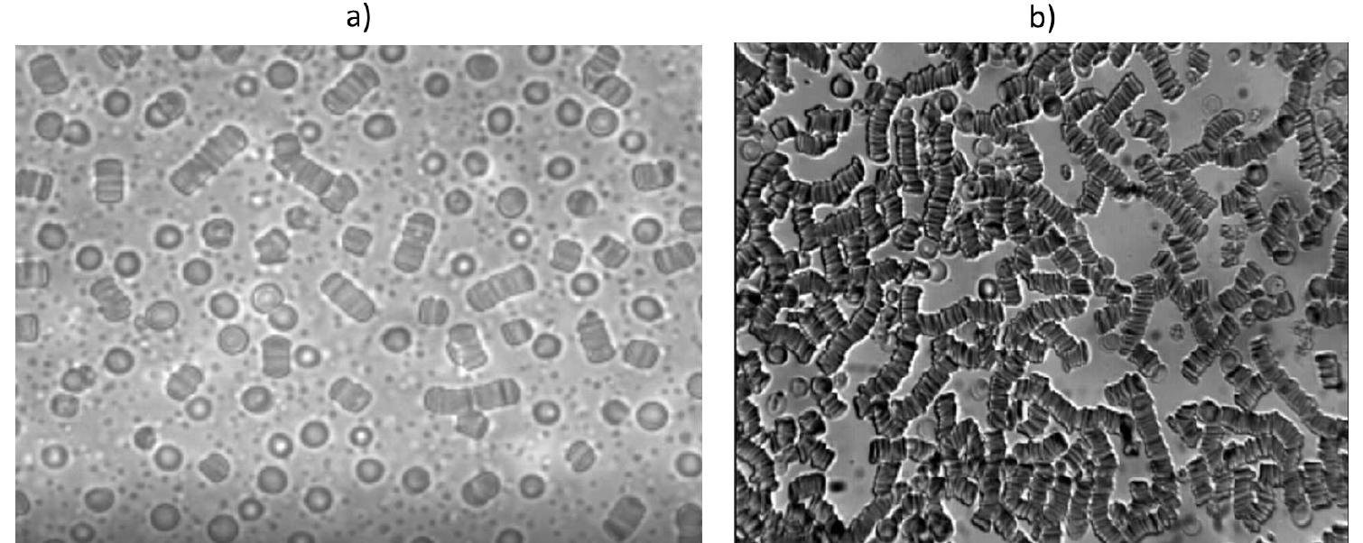 Aggregation Rbc Microscope (PDF) Microfluidics Approach to the Mechanical Properties of Red Blood ...
