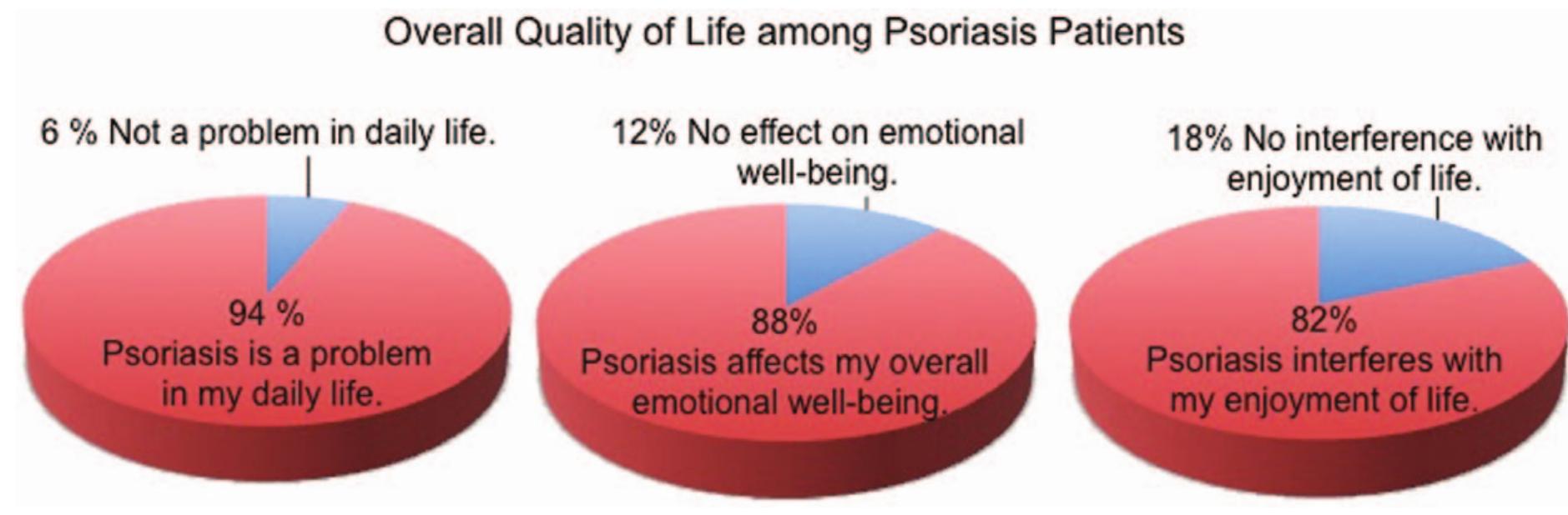 (PDF) Quality of Life and Work Productivity Impairment among Psoriasis ...