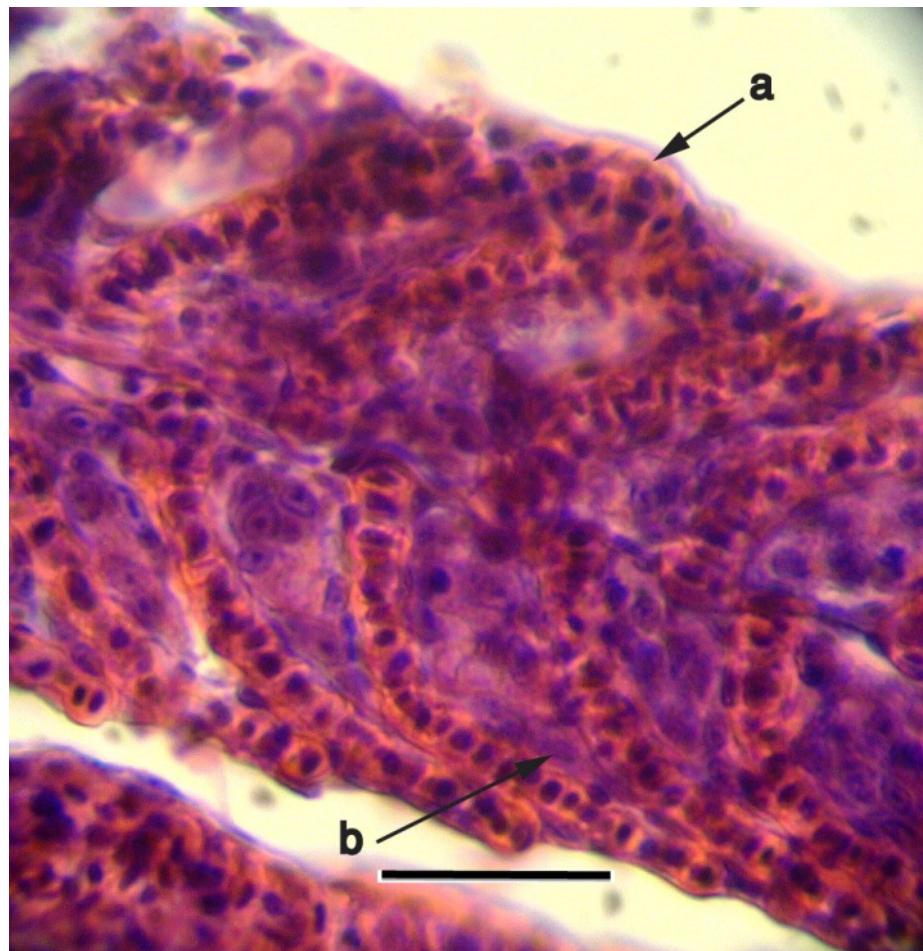 (PDF) Histopathological changes of gill, liver and kidney in Caspian ...
