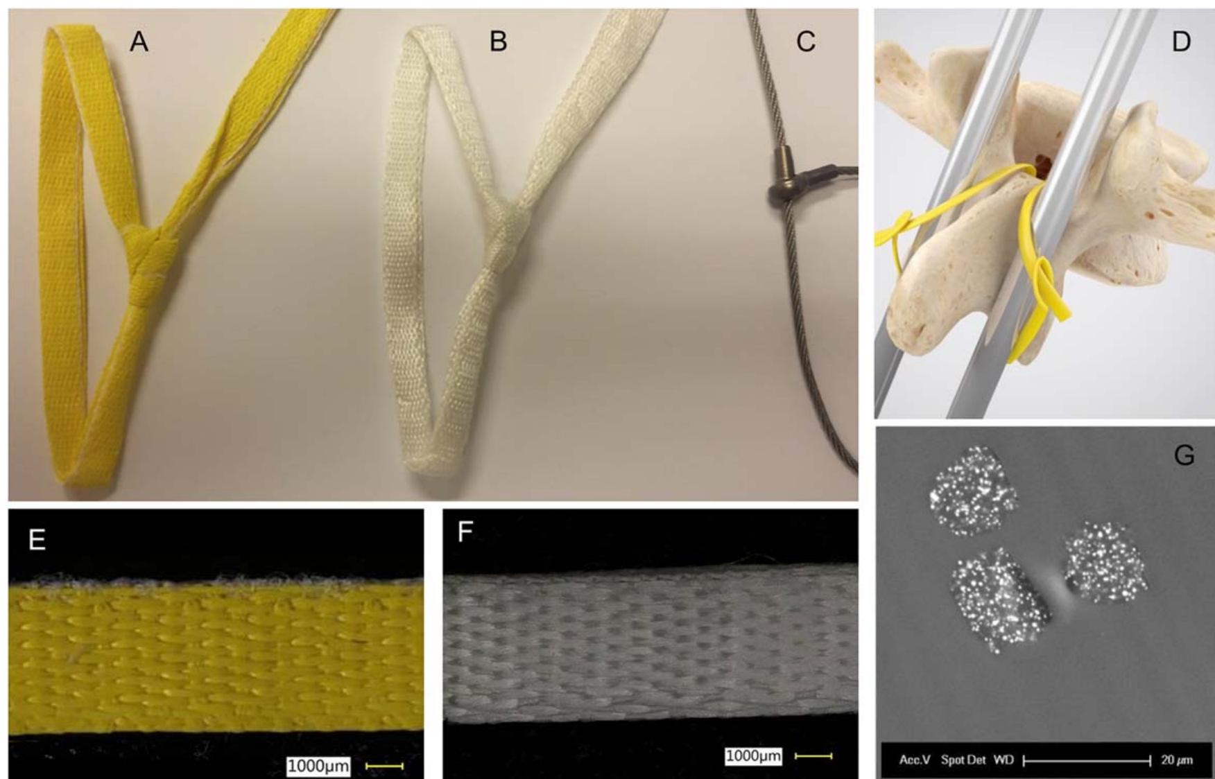 (PDF) Radiopaque UHMWPE sublaminar cables for spinal deformity ...