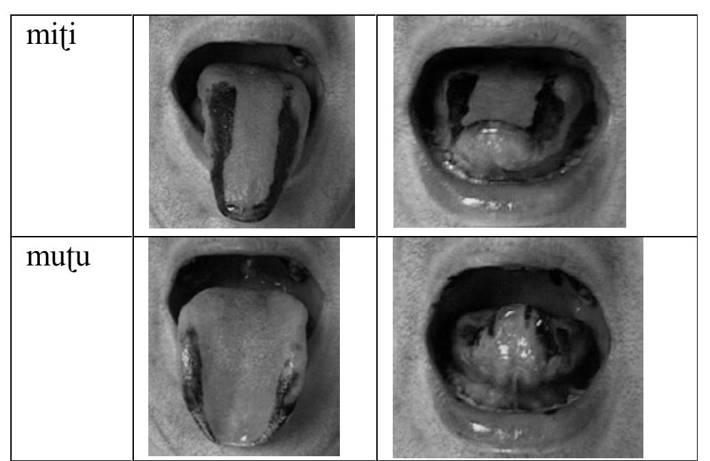 Khatiwada / 27  If a majority of participants of the first experience used the rim (tongue tip, see Catforc 1977), we observed, in the second experience- especially during the production of /i/ anc /u/- the presence of more sub-apical contact i.e. tongue tip is retroflexed. Contrary tc Pokharel who had claimed that Nepali does not possess any retroflex consonants but onl} apico-alveolar type (Pokharel 1989), our study found different types of lingua configuration and show that retroflex consonants do exist in Nepali. 