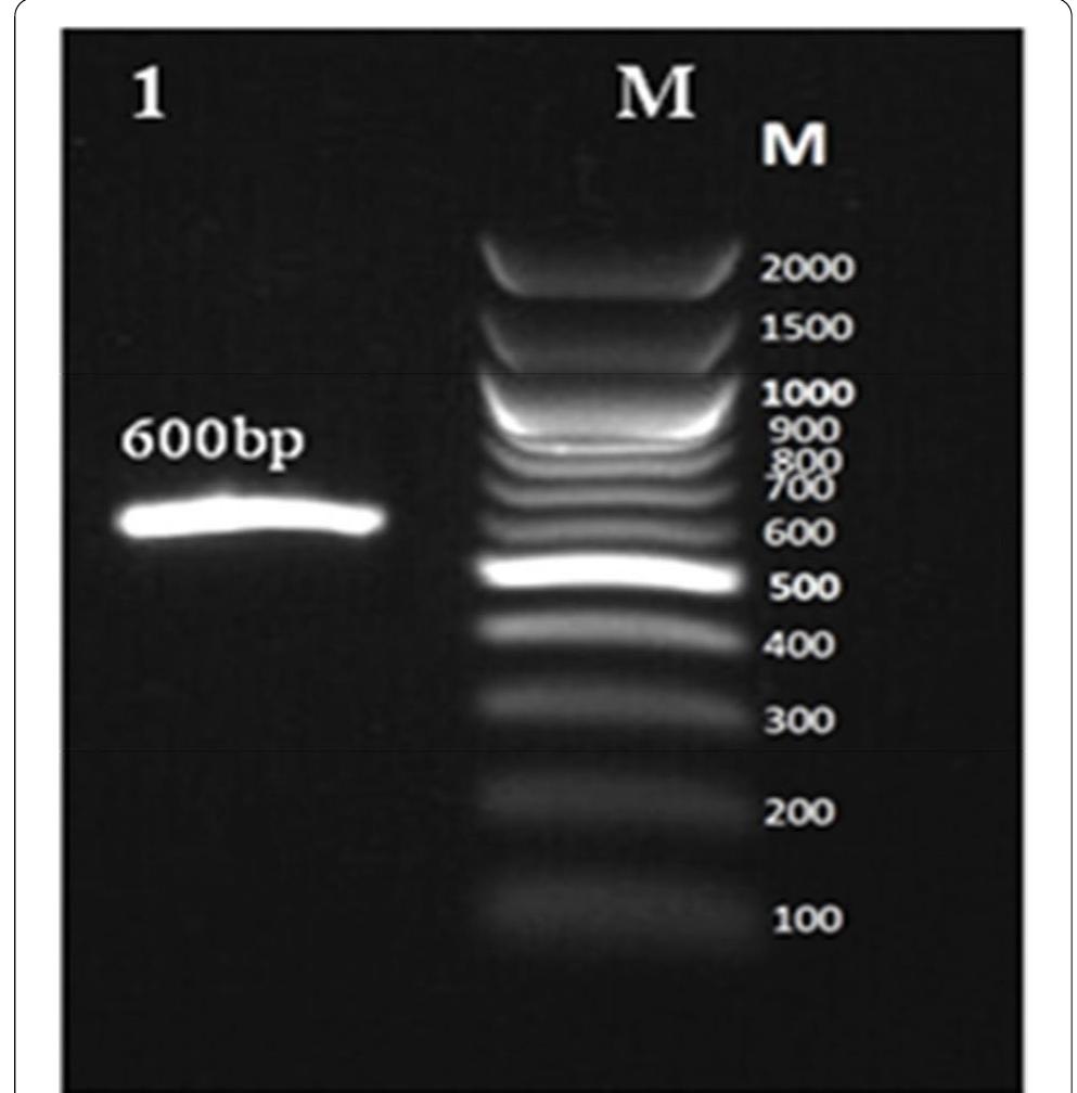 Agarose gel electrophoresis for pcr product (600 bp) of its