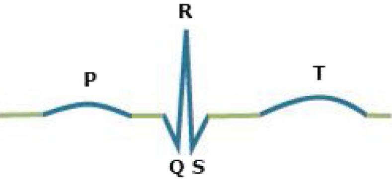 Figure 1 - from A robust QRS complex detection using regular