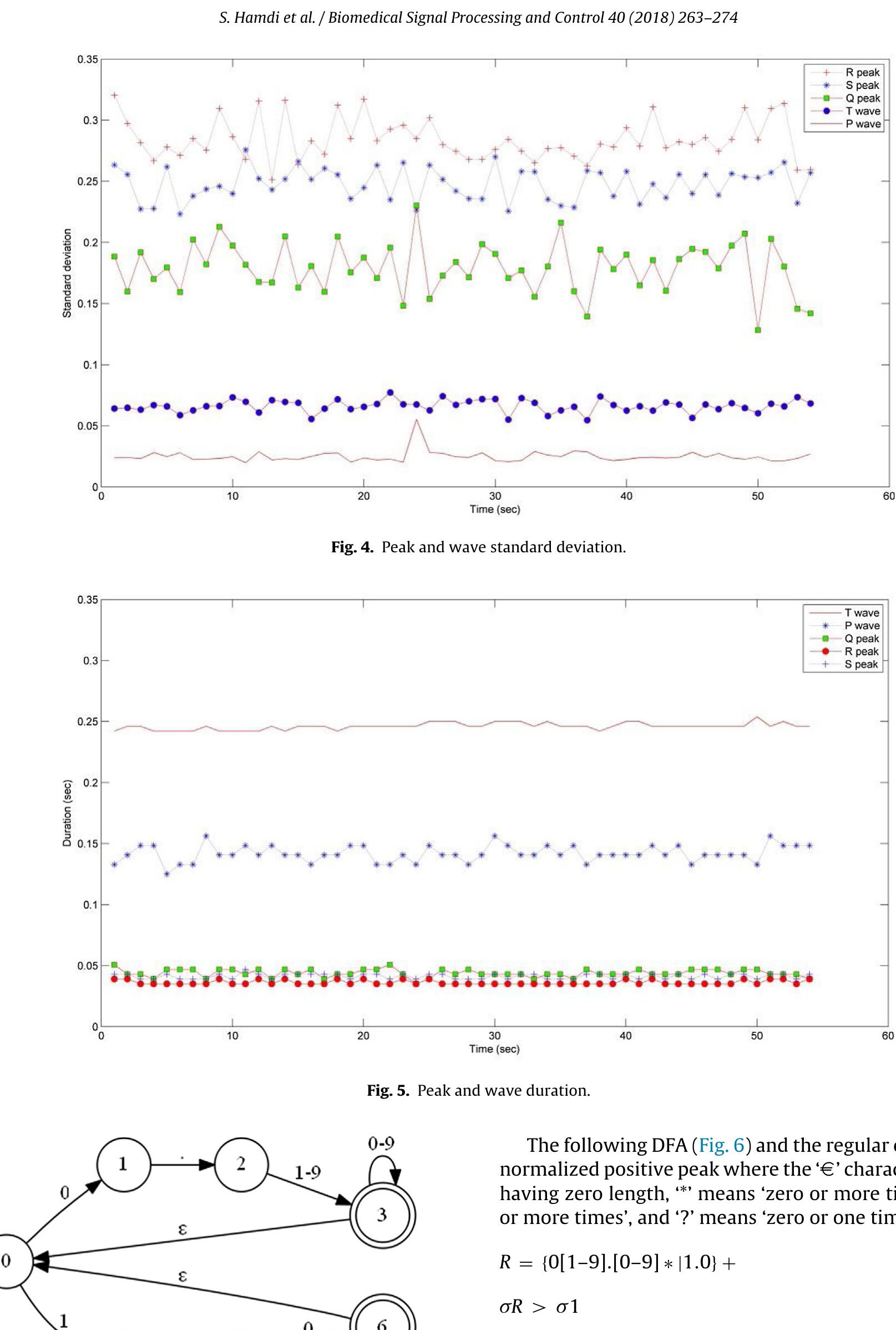 Figure 1 - from A robust QRS complex detection using regular